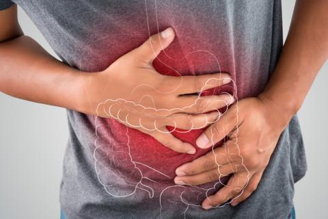colitis-1